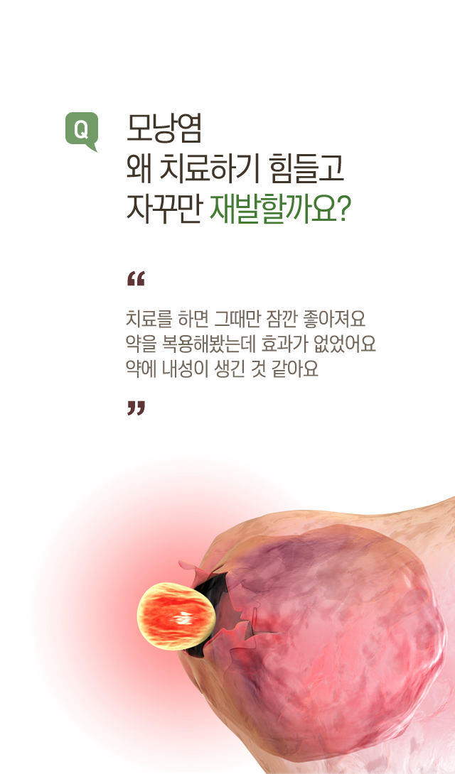 모낭염